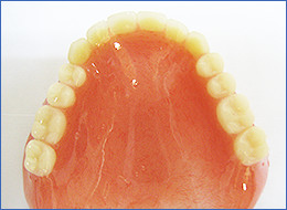 レジン床デンチャー（保険適用）